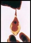 teardrop