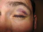 Handball
