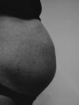 bauch_27_3.jpg