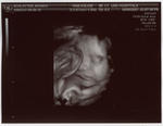 32nd week ultrasound